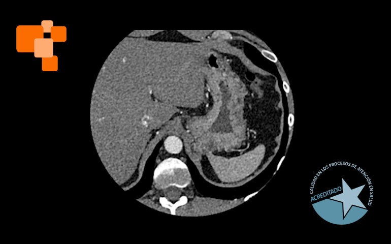 Centro de Imagenología San Lorenzo Santa Cruz