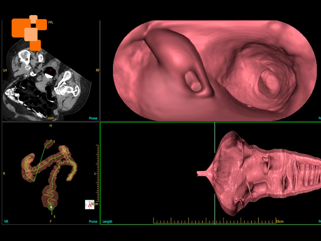 Gina Sarmiento especialista en TAC 128 canales
